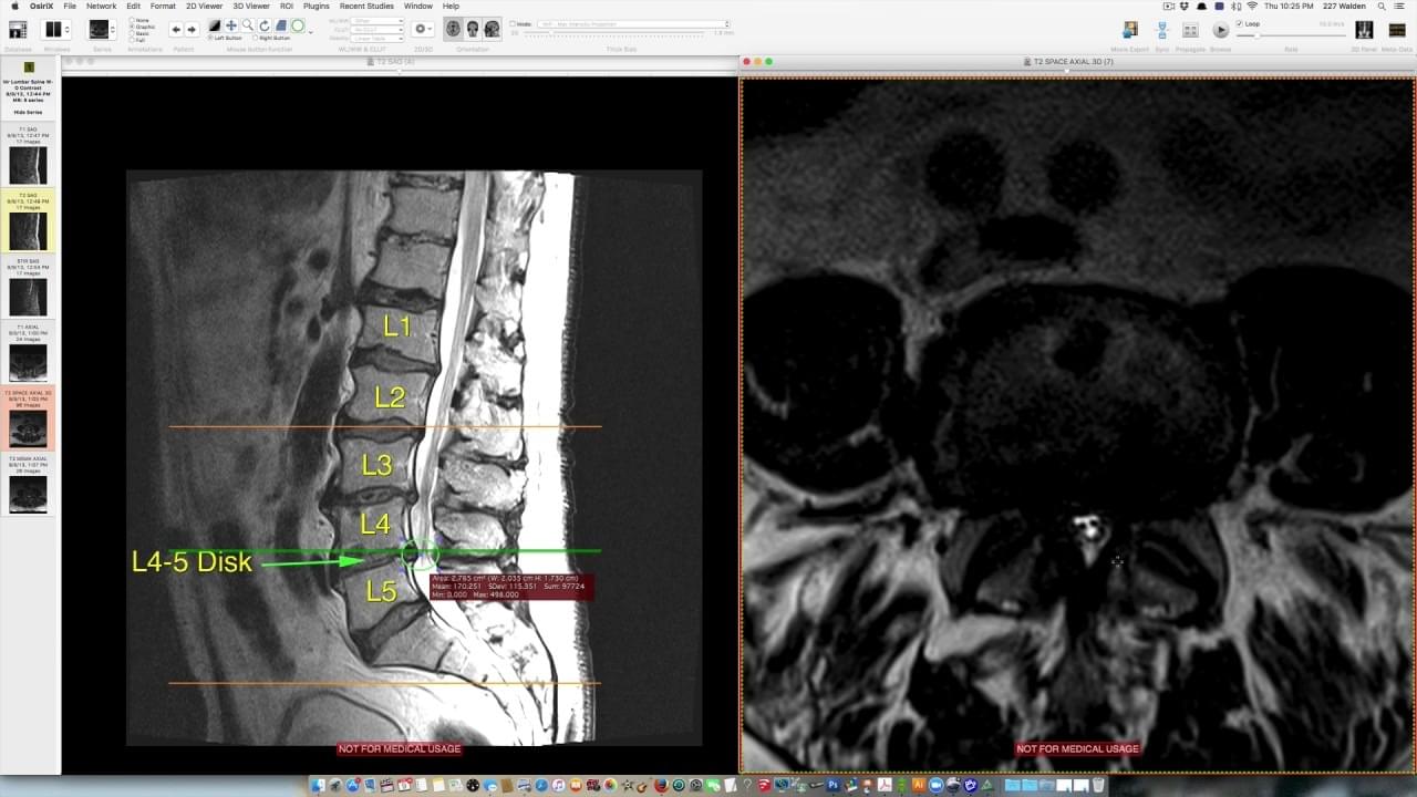 Spine anatomy