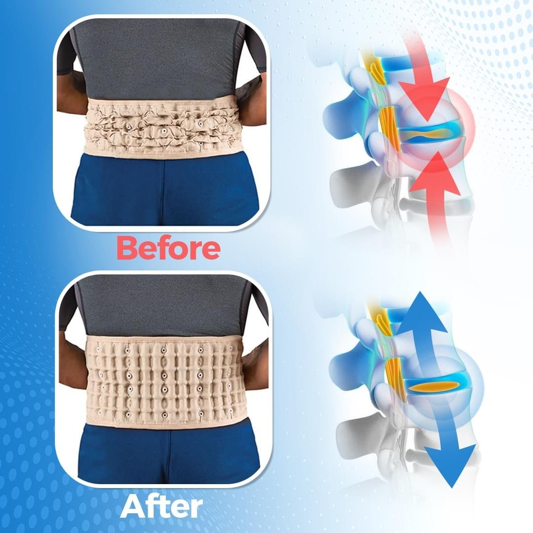 Back therapy device
